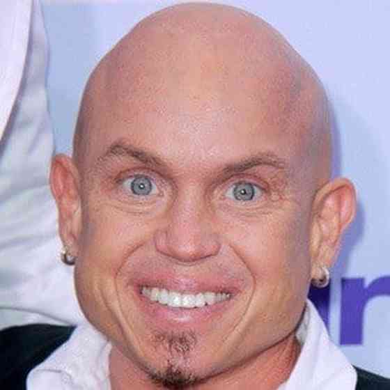 Martin Klebba Net Worth, Height, Age, and More